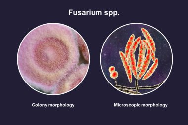 Fusarium mantarları, mikroskobik yapıyı (sağda) gösteren 3D illüstrasyon ve koloni morfolojisini (solda) gösteren fotoğraf).