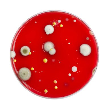 Bakteriyel ve küf mantarı kolonileri kan koyunları üzerinde kapalı havadan yetişiyor, mikrobik çeşitlilik ve hava kirliliği gösteren fotoğraflar sergiliyor..