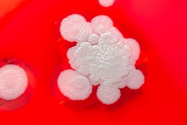 Küf mantarı kolonileri, kapalı alandaki havadan yetiştirilmiş kan koyunları üzerinde büyümüş, mikrobik çeşitlilik ve hava kirliliği gösteren fotoğraflar sergiliyor..