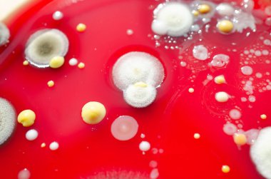 Küf mantarı kolonileri, kapalı alandaki havadan yetiştirilmiş kan koyunları üzerinde büyümüş, mikrobik çeşitlilik ve hava kirliliği gösteren fotoğraflar sergiliyor..