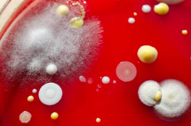 Küf mantarı kolonileri, kapalı alandaki havadan yetiştirilmiş kan koyunları üzerinde büyümüş, mikrobik çeşitlilik ve hava kirliliği gösteren fotoğraflar sergiliyor..