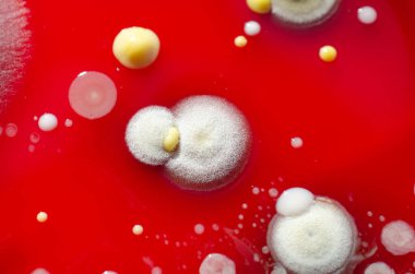 Küf mantarı kolonileri, kapalı alandaki havadan yetiştirilmiş kan koyunları üzerinde büyümüş, mikrobik çeşitlilik ve hava kirliliği gösteren fotoğraflar sergiliyor..