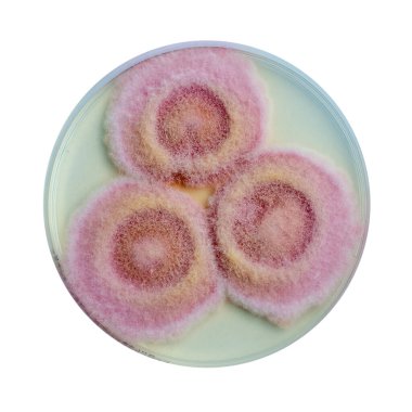 Fusarium mantar kolonileri patates dekstroz agar üzerinde, fotoğraf pamuk dokusunu ve pigmentasyonu gösteriyor. Keratite, onychomycosis, fusariosis neden olur.