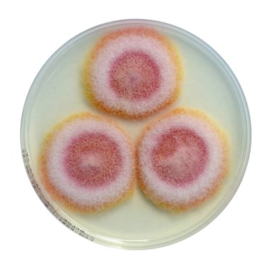 Fusarium mantar kolonileri patates dekstroz agar üzerinde, fotoğraf pamuk dokusunu ve pigmentasyonu gösteriyor. Keratite, onychomycosis, fusariosis neden olur.