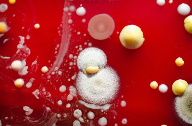 Bakteriyel ve küf mantarı kolonileri kan koyunları üzerinde kapalı havadan yetişiyor, mikrobik çeşitlilik ve hava kirliliği gösteren fotoğraflar sergiliyor..