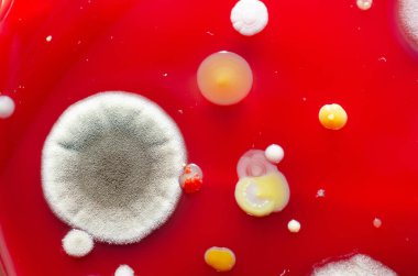 Bakteriyel ve küf mantarı kolonileri kan koyunları üzerinde kapalı havadan yetişiyor, mikrobik çeşitlilik ve hava kirliliği gösteren fotoğraflar sergiliyor..