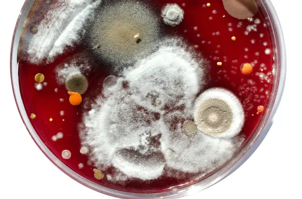 Küf mantarı kolonileri, kapalı alandaki havadan yetiştirilmiş kan koyunları üzerinde büyümüş, mikrobik çeşitlilik ve hava kirliliği gösteren fotoğraflar sergiliyor..