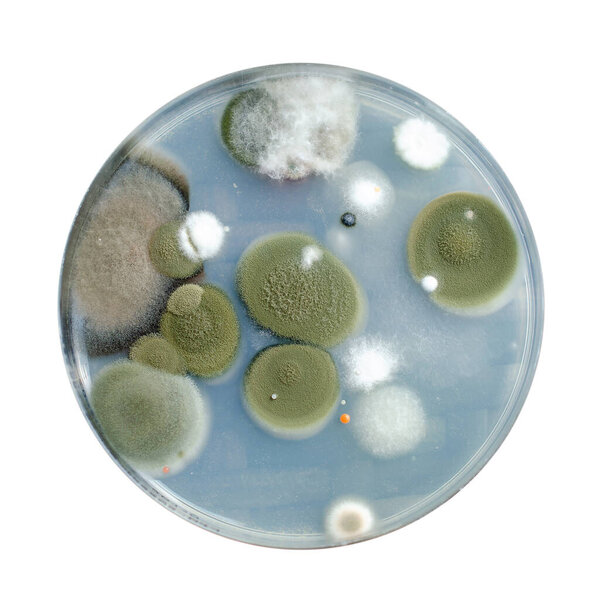 Плесень колонии грибов, выращенных из воздуха в помещении на картофельном декстрозе агар, фотографии, демонстрирующие микробное разнообразие и загрязнение воздуха.