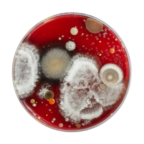 Küf mantarı kolonileri, kapalı alandaki havadan yetiştirilmiş kan koyunları üzerinde büyümüş, mikrobik çeşitlilik ve hava kirliliği gösteren fotoğraflar sergiliyor..