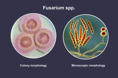 Fusarium mantarları, mikroskobik yapıyı (sağda) gösteren 3D illüstrasyon ve koloni morfolojisini (solda) gösteren fotoğraf).
