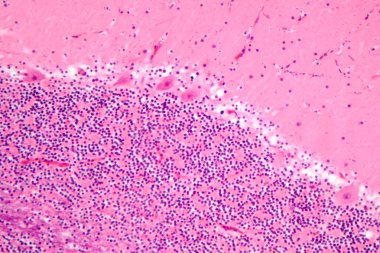 İnsan beyinciği, Purkinje hücrelerini, granüler hücreleri ve motor koordinasyon ve dengede yer alan moleküler katmanı gösteren fotoğraf mikroskobu..