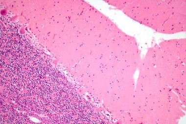 İnsan beyinciği, Purkinje hücrelerini, granüler hücreleri ve motor koordinasyon ve dengede yer alan moleküler katmanı gösteren fotoğraf mikroskobu..