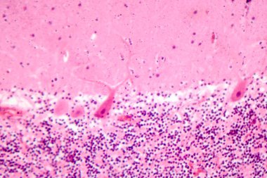 İnsan beyinciği, Purkinje hücrelerini, granüler hücreleri ve motor koordinasyon ve dengede yer alan moleküler katmanı gösteren fotoğraf mikroskobu..