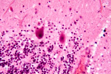 İnsan beyinciği, Purkinje hücrelerini, granüler hücreleri ve motor koordinasyon ve dengede yer alan moleküler katmanı gösteren fotoğraf mikroskobu..