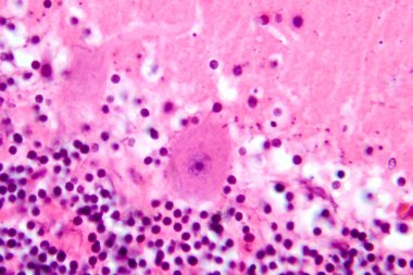 İnsan beyinciği, Purkinje hücrelerini, granüler hücreleri ve motor koordinasyon ve dengede yer alan moleküler katmanı gösteren fotoğraf mikroskobu..