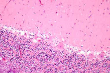 İnsan beyinciği, Purkinje hücrelerini, granüler hücreleri ve motor koordinasyon ve dengede yer alan moleküler katmanı gösteren fotoğraf mikroskobu..