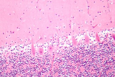 İnsan beyinciği, Purkinje hücrelerini, granüler hücreleri ve motor koordinasyon ve dengede yer alan moleküler katmanı gösteren fotoğraf mikroskobu..