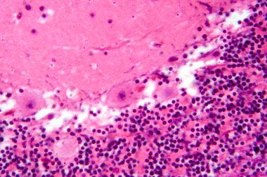 İnsan beyinciği, Purkinje hücrelerini, granüler hücreleri ve motor koordinasyon ve dengede yer alan moleküler katmanı gösteren fotoğraf mikroskobu..