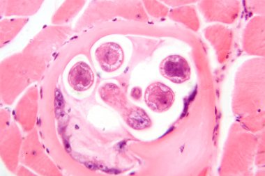 Kas dokusunda trichinella spiralis larvası, ansiklopedik parazitleri gösteren fotomikrograf. Trişinoz 'a neden olur, az pişmiş etten kaynaklanan parazit bir enfeksiyon..