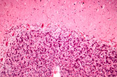 İnsan motor korteksi, fotomikrograf kortikal katmanlarda piramit nöronları gösteriyor gönüllü hareket kontrolü ve motor koordinasyonundan sorumlu..