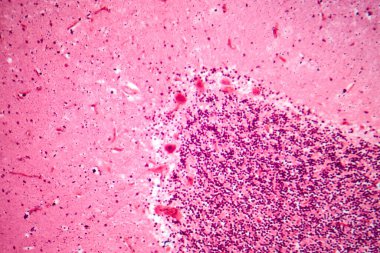 İnsan motor korteksi, fotomikrograf kortikal katmanlarda piramit nöronları gösteriyor gönüllü hareket kontrolü ve motor koordinasyonundan sorumlu..