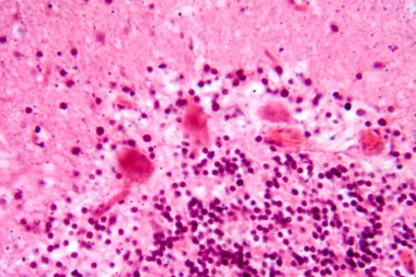 İnsan motor korteksi, fotomikrograf kortikal katmanlarda piramit nöronları gösteriyor gönüllü hareket kontrolü ve motor koordinasyonundan sorumlu..