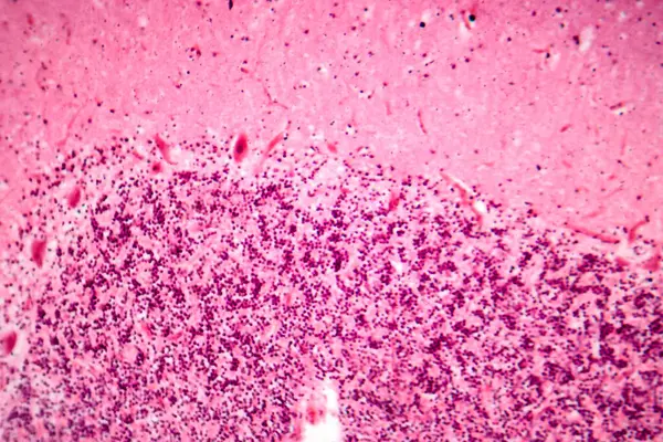 İnsan motor korteksi, fotomikrograf kortikal katmanlarda piramit nöronları gösteriyor gönüllü hareket kontrolü ve motor koordinasyonundan sorumlu..