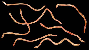 Brachyspira pilosicoli, sarmal şekilli anaerobik bakterinin insan ve hayvanlarda bağırsak sarmalına ve bağırsak iltihabına yol açtığını gösteren 3 boyutlu bir illüstrasyon..