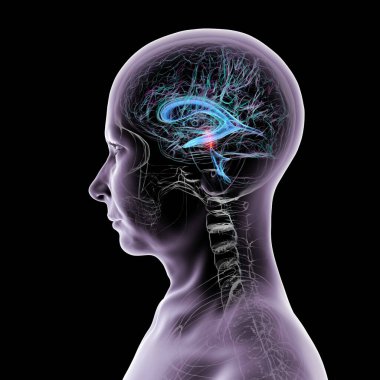 Serebral su kemerli beyin kırmızıyla işaretlenmiş ve ventriküler sistem mavi renkte serebrospinal sıvı akışı gösteriyor..