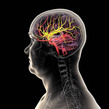 Beynin orta serebral arteri (sarı) vurgulanmış arteriyel kan akışı, ön, şakak ve yan loblara kan sağlanması, beyin fonksiyonları için hayati önem taşımaktadır..