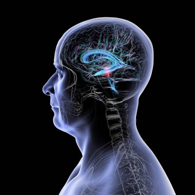 Serebral su kemerli beyin kırmızıyla işaretlenmiş ve ventriküler sistem mavi renkte serebrospinal sıvı akışı gösteriyor..