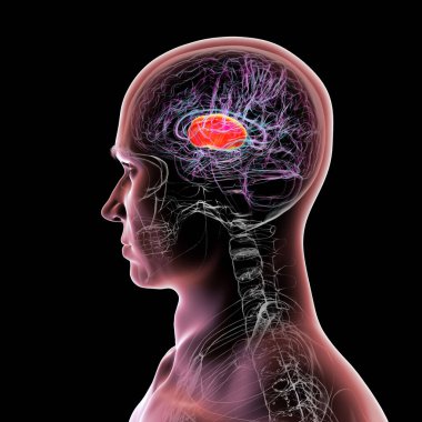 İnsan beyninin içindeki iç kapsül (kırmızı), 3 boyutlu illüstrasyon. Bu beyaz madde yapısı motor ve duyusal sinyal iletimi için çok önemli, lezyonlar felce ya da duyusal kayıplara neden olabilir..