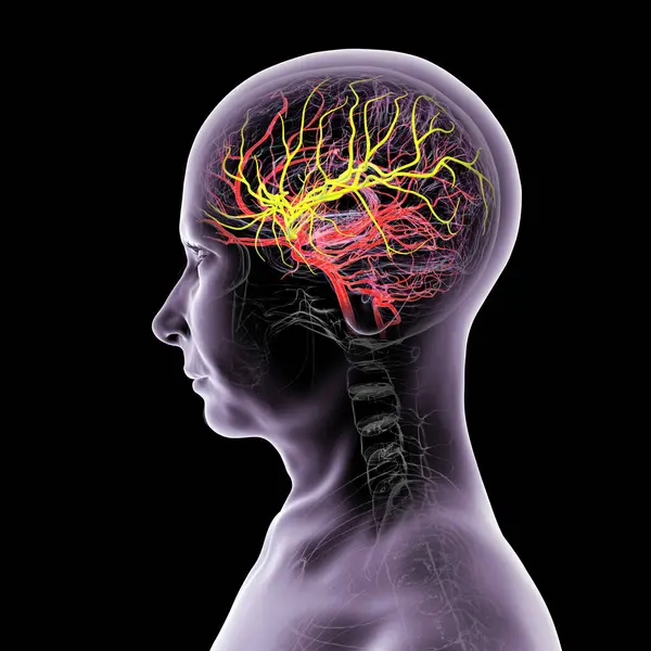 Beynin orta serebral arteri (sarı) vurgulanmış arteriyel kan akışı, ön, şakak ve yan loblara kan sağlanması, beyin fonksiyonları için hayati önem taşımaktadır..