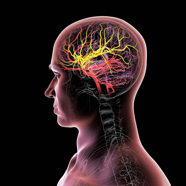 Beynin orta serebral arteri (sarı) vurgulanmış arteriyel kan akışı, ön, şakak ve yan loblara kan sağlanması, beyin fonksiyonları için hayati önem taşımaktadır..