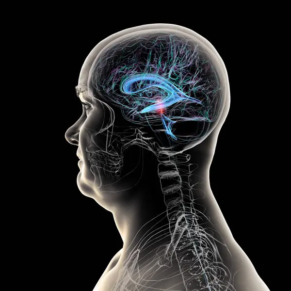 Serebral su kemerli beyin kırmızıyla işaretlenmiş ve ventriküler sistem mavi renkte serebrospinal sıvı akışı gösteriyor..