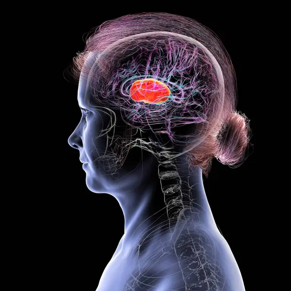 İnsan beyninin içindeki iç kapsül (kırmızı), 3 boyutlu illüstrasyon. Bu beyaz madde yapısı motor ve duyusal sinyal iletimi için çok önemli, lezyonlar felce ya da duyusal kayıplara neden olabilir..