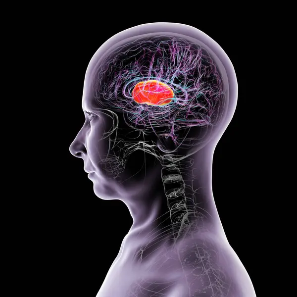 İnsan beyninin içindeki iç kapsül (kırmızı), 3 boyutlu illüstrasyon. Bu beyaz madde yapısı motor ve duyusal sinyal iletimi için çok önemli, lezyonlar felce ya da duyusal kayıplara neden olabilir..