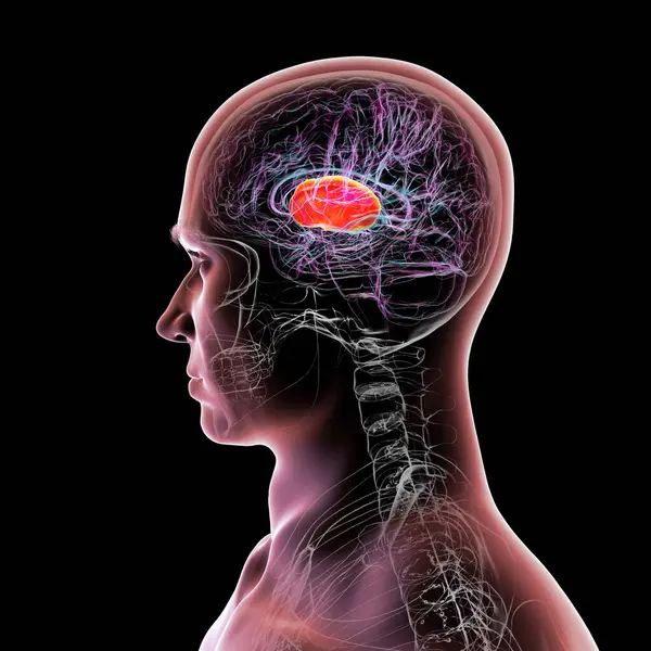 İnsan beyninin içindeki iç kapsül (kırmızı), 3 boyutlu illüstrasyon. Bu beyaz madde yapısı motor ve duyusal sinyal iletimi için çok önemli, lezyonlar felce ya da duyusal kayıplara neden olabilir..