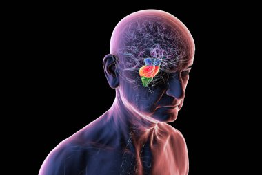 Vurgulanmış beyin sapı olan, temel yaşam fonksiyonları için hayati önem taşıyan ve Parkinson ve Alzheimer gibi yaşla ilgili nörodejeneratif hastalıklarda etkilenen üst düzey bir insanda insan beyni..