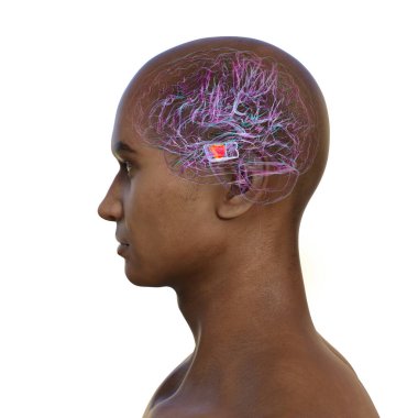 İnsan beyni, orta beyinde önemli bir zenci altını çizmiş, hareket düzenlemesinde kilit bir yapı ve Parkinson hastalığından etkilenmiş, 3 boyutlu illüstrasyon.