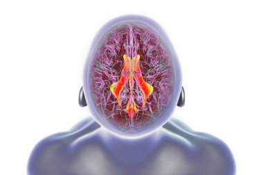 Beynin ventriküler sistemi, 3 boyutlu illüstrasyon. Karıncıklar beyindeki boşluklardır ve serebrospinal sıvıyla doludur (CSF).