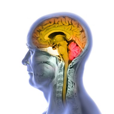 Beynin ve boynun renkli manyetik rezonans görüntüleme (MRI) taraması, merkezi sinir sistemi anatomisi ve servikal omurgayı gösteren 3 boyutlu illüstrasyon. Beyin ve omurilik turuncu ve beyincik kırmızıyla vurgulanır..