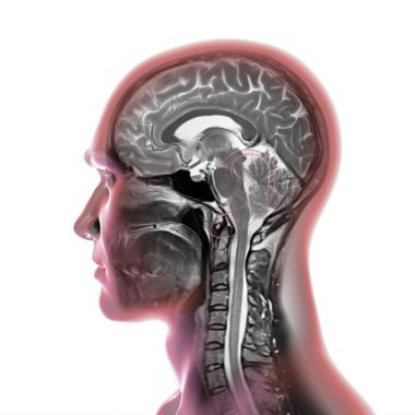 Beynin ve boynun renkli manyetik rezonans görüntüleme (MRI) taraması, merkezi sinir sistemi anatomisi ve servikal omurgayı gösteren 3D illüstrasyon.