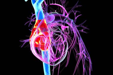 Sağ atriyum (kırmızı) ve üst ve alt vena cava (mavi), üç boyutlu illüstrasyon. Kalbe deoksijensiz kan geri döner, akciğer hipertansiyonunda ve sağ kalp yetmezliğinde genişleme meydana gelir..