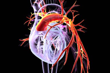 Akciğer gövdesi kırmızıyla işaretlenmiş, 3 boyutlu illüstrasyon ana damar anatomisini gösteriyor. Akciğerlere deoksijenli kan taşıyan ana atardamar pulmoner hipertansiyon ve embolizmadan etkilenmiş..