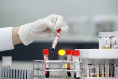 Hospital. Adrenalin box. Health and medicine. 