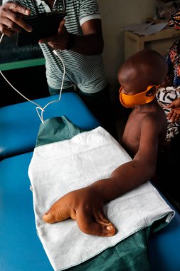 Afrika hastanesi. Pediyatri ünitesi. Tıbbi danışmanlık. Benin.. 