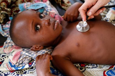 Afrika hastanesi. Pediyatri ünitesi. Tıbbi danışmanlık. Steteskop. Benin.. 