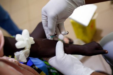 Afrika 'daki bir hastanede biyoloji. Kan örneklerini test eden bir laboratuvar teknisyeni Benin.. 