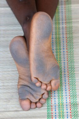 Genç bir okul çocuğunun kirli ayakları. Togo. 